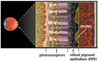 Selective-Laser